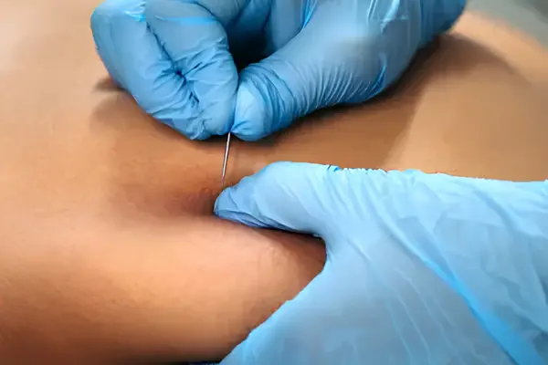 ims treatment (8)