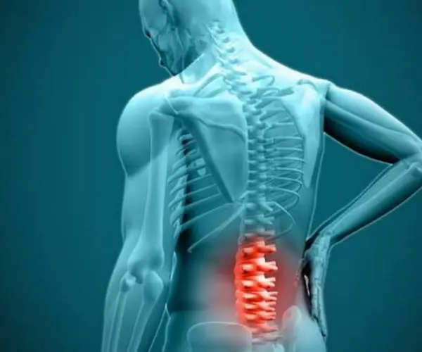 Herniated Disc Symptoms