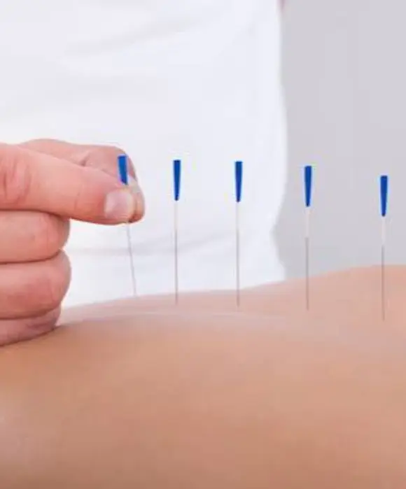 Intramuscular Stimulation